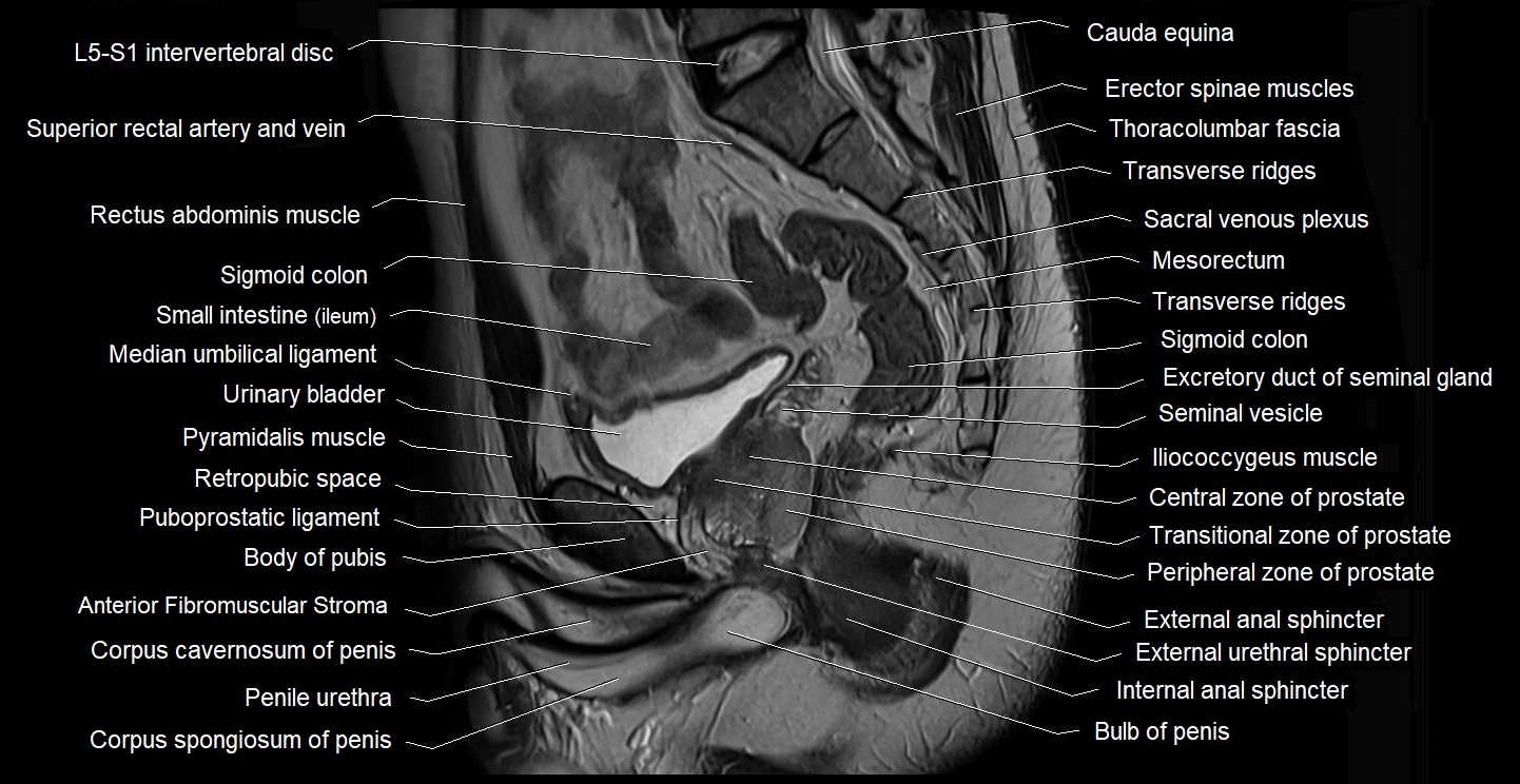 male pelvis sagittal cross sectional anatomy 3T mri image 22.webp